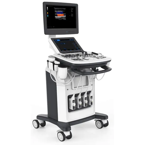 Full Digital Portable 3D 4D Color Doppler Abdominal Ultrasound System