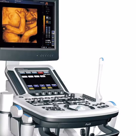 Full Digital Portable 3D 4D Color Doppler Abdominal Ultrasound System