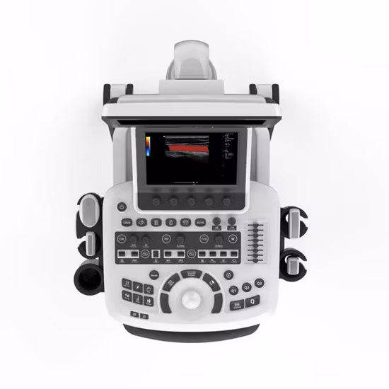 Full Digital Portable 3D 4D Color Doppler Abdominal Ultrasound System