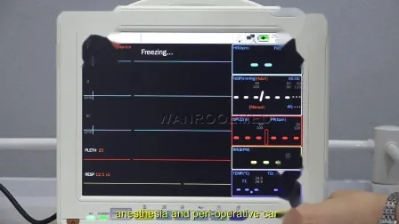 Etco2 Anesthesia Medical CE Multi-Parameter ICU Monitor de paciente