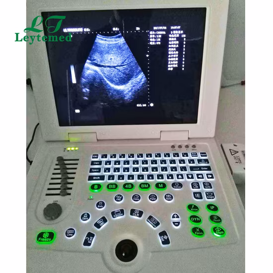 Ltub47 Máquina de ultrasonido cardíaco para hospital Portátil portátil B / W Sistema de escáner de ultrasonido digital Precio