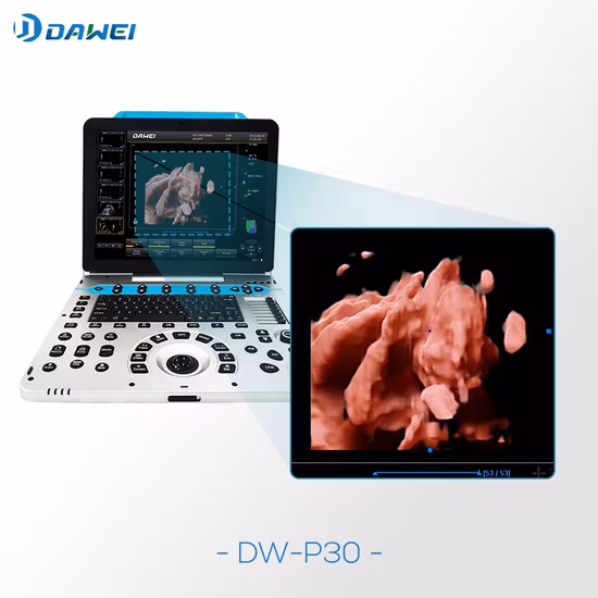Ecocardiografía móvil portátil completamente Digital, ecografía cardíaca, ecografía, máquina de ultrasonido Doppler a Color portátil para el embarazo