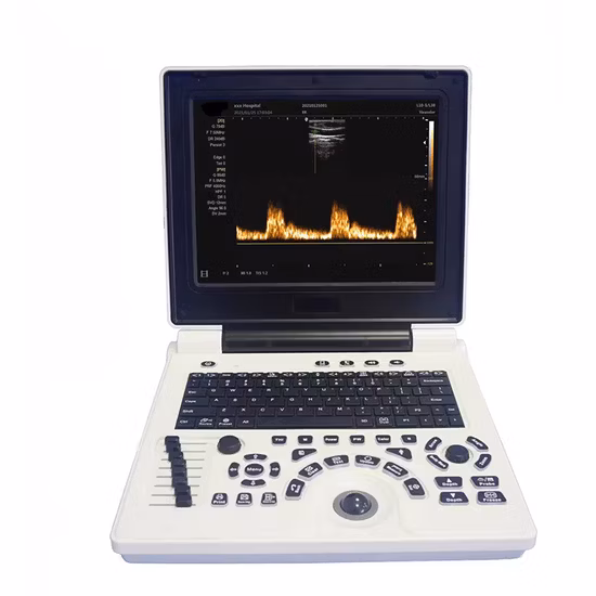 IN-AK0 Color Doppler Interfaz Todo el sistema de diagnóstico ultrasónico digital Precio de la máquina de ultrasonido